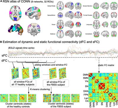 Case report: The promising application of dynamic functional connectivity analysis on an individual with failed back surgery syndrome